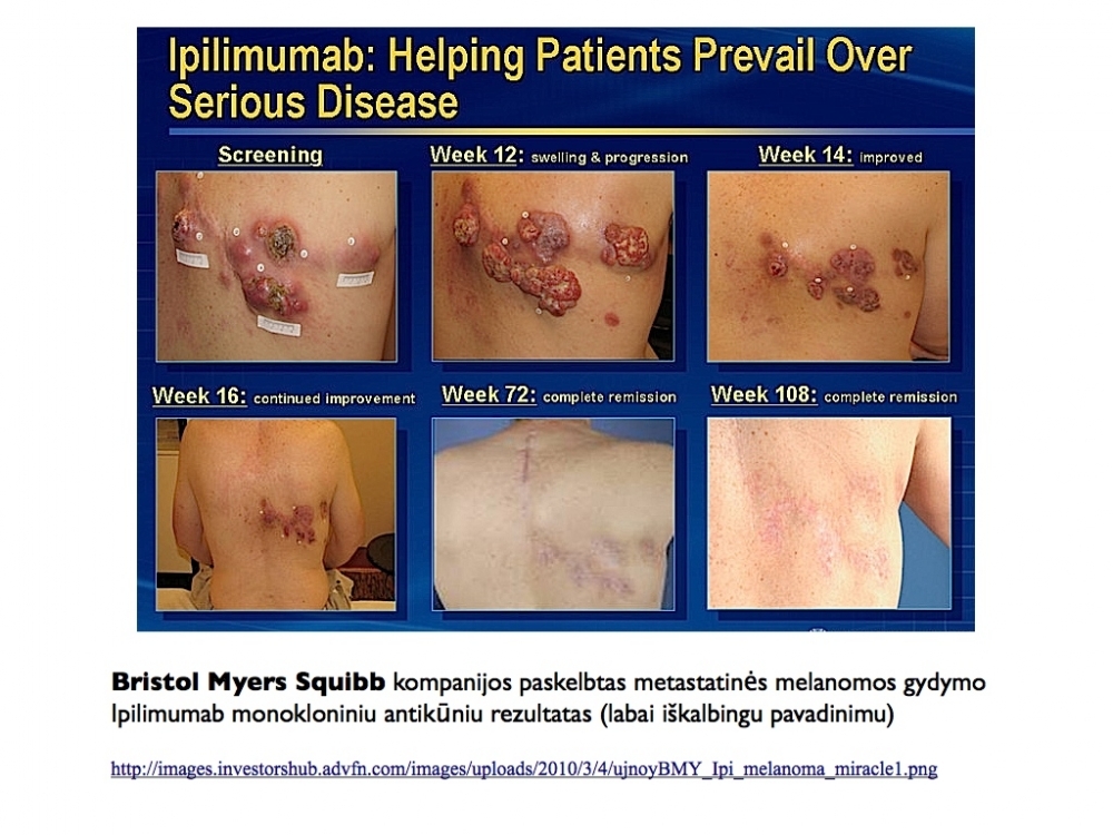 Metastatrin melanoma